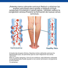 South Moon Vein Relief Cream for Spider Veins